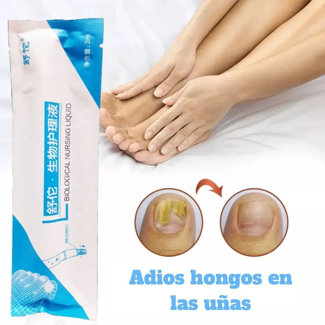 Esmalte Potente Antimicótico para Hongos (Leuconychia)💯