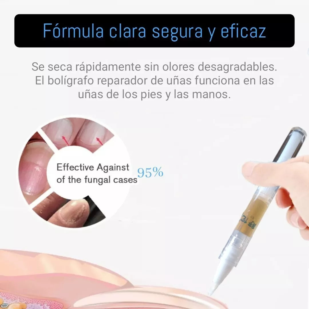 Esmalte Potente Antimicótico para Hongos (Leuconychia)💯