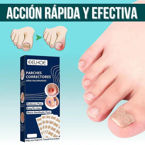 EASY PATCH - PARCHES CORRECTOR DE UÑAS (PACK POR 50 UND)