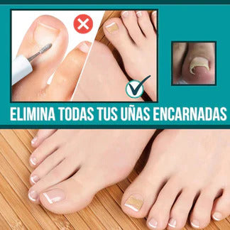 EASY PATCH - PARCHES CORRECTOR DE UÑAS (PACK POR 50 UND)